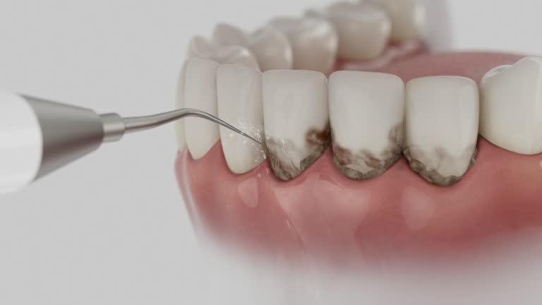 Reliable Dental Implants contractor in Bloomington, IN by Smile Center Dentistry